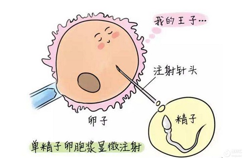 专家：久备不孕？做美国试管婴儿让您少走许多弯路！