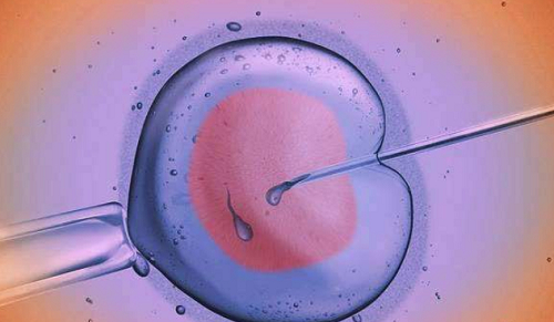 卵巢位置异常，影响美国试管婴儿取卵操作吗？